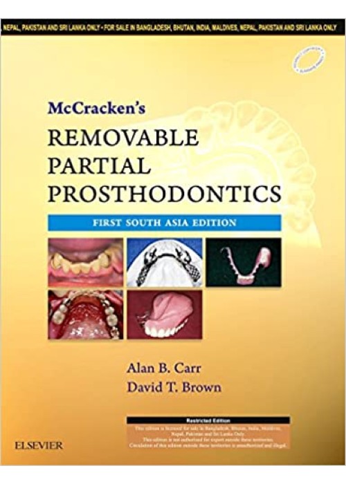 Mccracken's Removable Partial Prosthodontics 